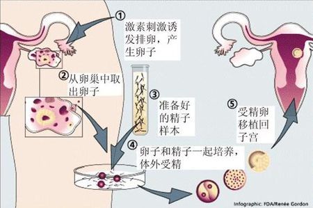 璟华生殖医学中心